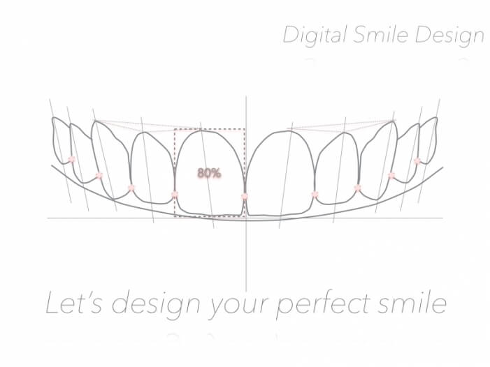 Smile Design Dental Plano At Richard Montejano Blog